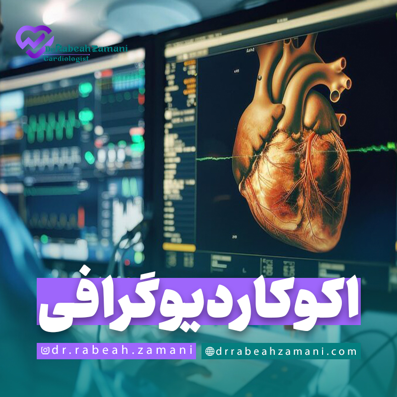 اکوکاردیوگرافی