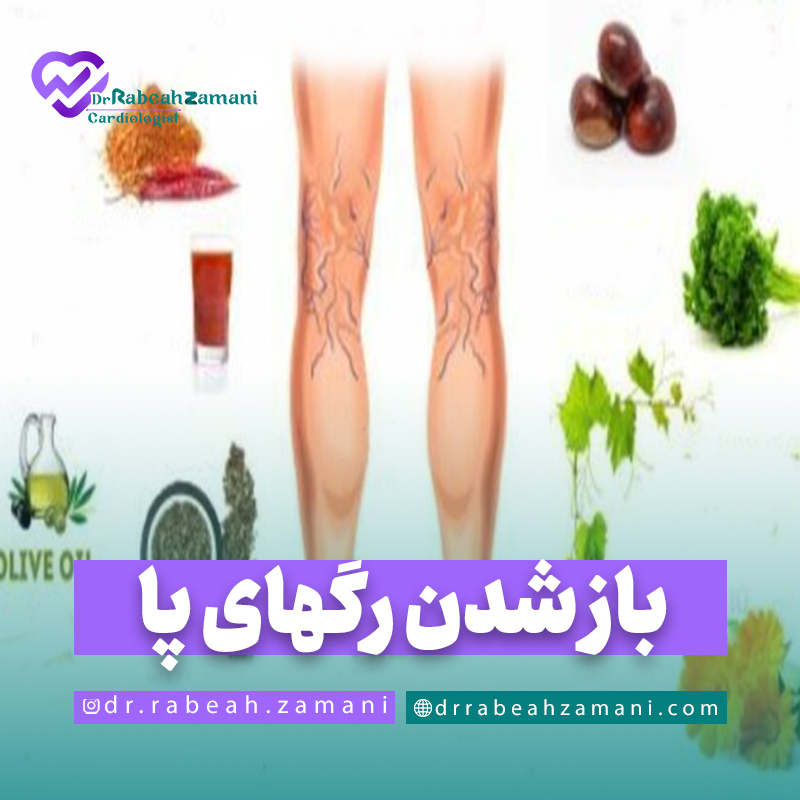 برای باز شدن رگهای پا چه بخوریم؟